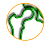 chir_hanche_rond